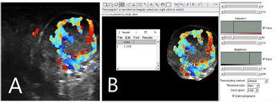 Early Prediction of Corpus Luteum Functionality Using an Imaging Software